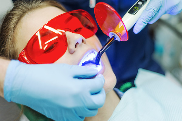 Laser Dentistry Clearwater, FL